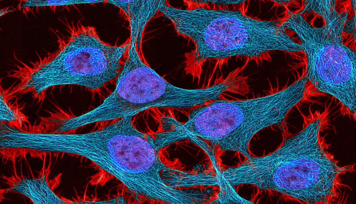 WR173 – Die Geschichte der unsterblichen Henrietta Lacks